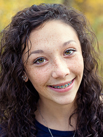 Metal Braces