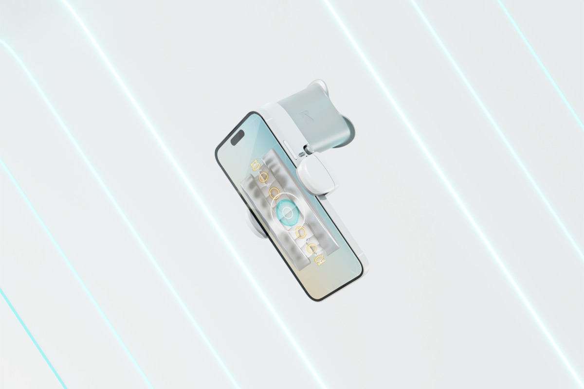 Smartphone attached to a DentalMonitoring ScanBox pro for at-home orthodontic scans